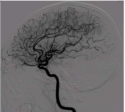 惠泰医疗：高速增长的小市值成长股-第4张图片-牧野网