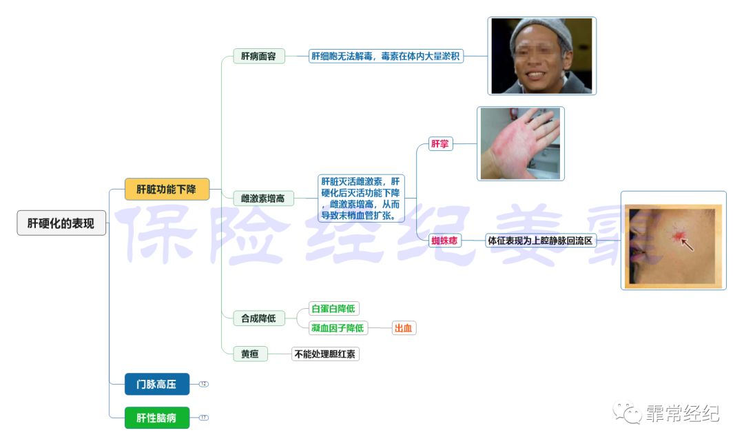 肝脏疾病如何买保险？肝脏疾病的保险使用指南-第8张图片-牧野网