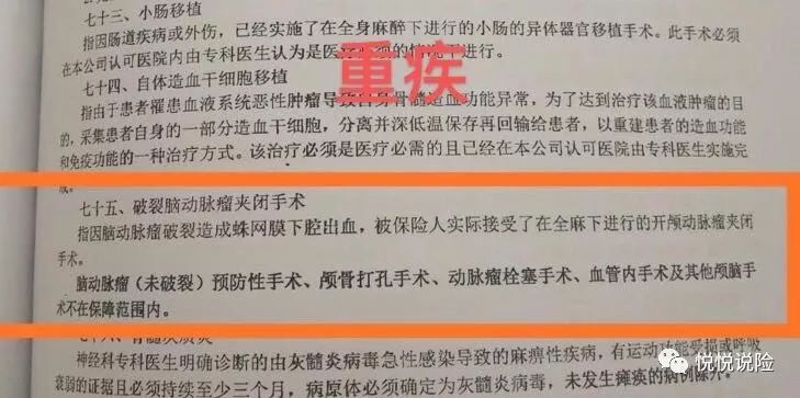 保险要开颅才能理赔，谁的错？-第2张图片-牧野网