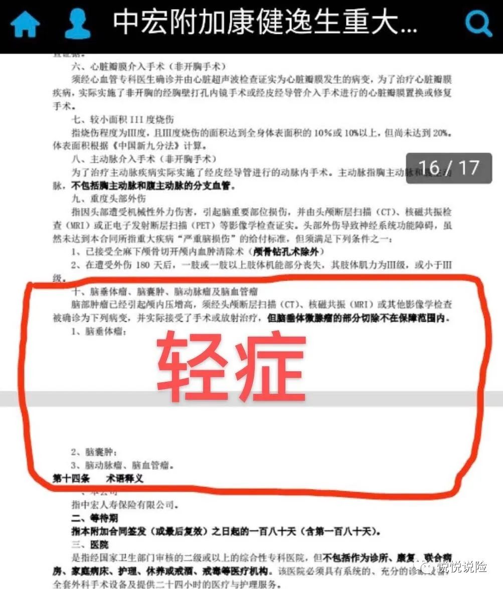 保险要开颅才能理赔，谁的错？-第3张图片-牧野网